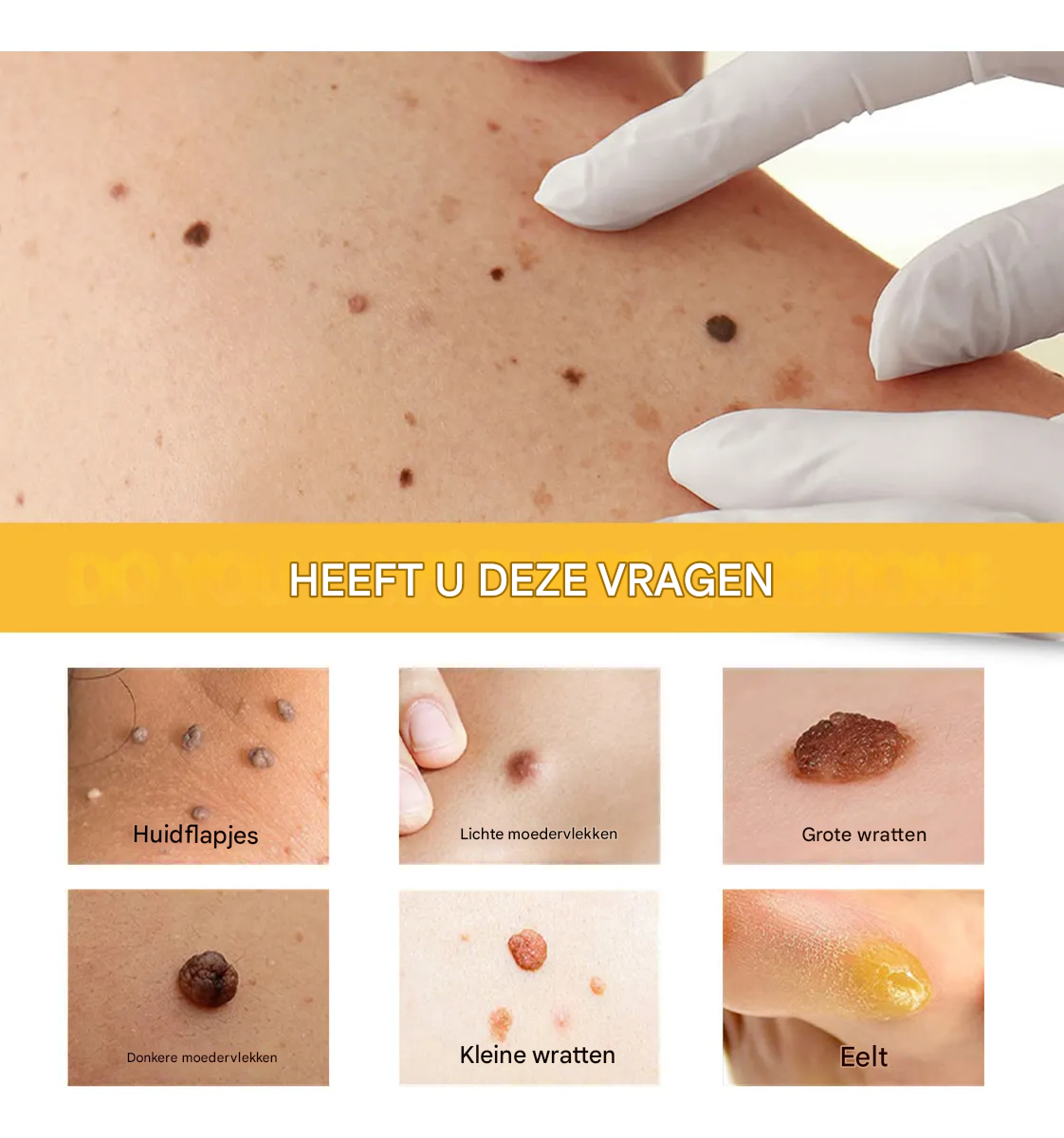 BeeNaturale™ – Entfernt Hautflapjes und Flecken sanft und effektiv [1 + 1 Gratis]