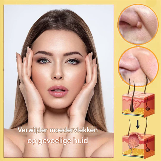 BeeNaturale™ – Sanfte und effektive Entfernung von Hautflapjes und Flecken [1 + 1 Gratis]