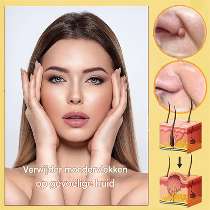 BeeNaturale™ – Entfernt Hautflapjes und Flecken sanft und effektiv [1 + 1 Gratis]